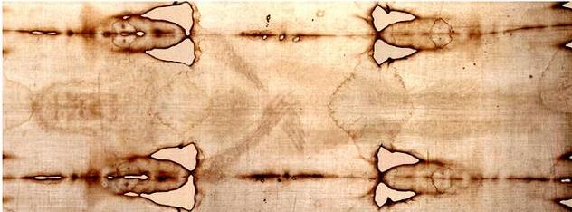 Shroud of Turin as it would look without those bloodstains. But the latter are the only evidence for the existence of wounds. There is no clear and unequivocal evidence for wounds in the basal body image.